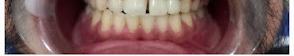 Pre-treatment Smile Assessment